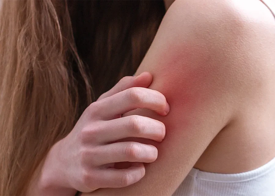 درمان بیماری‌های پوستی و قارچ