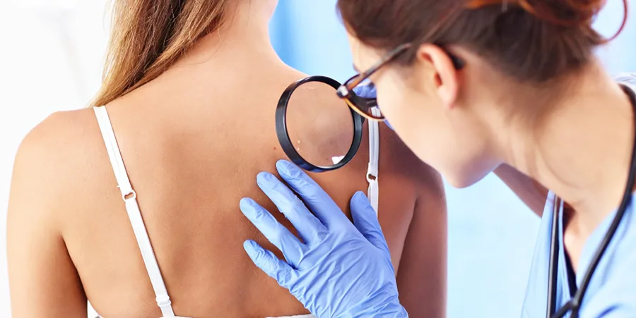 جراحی کیست‌‌های صورت، بدن و سر