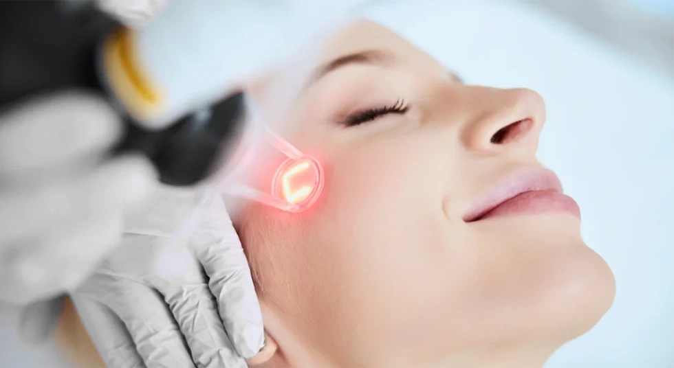 لیزر فرکس پرو شیراز برای جوانسازی و درمان پوست