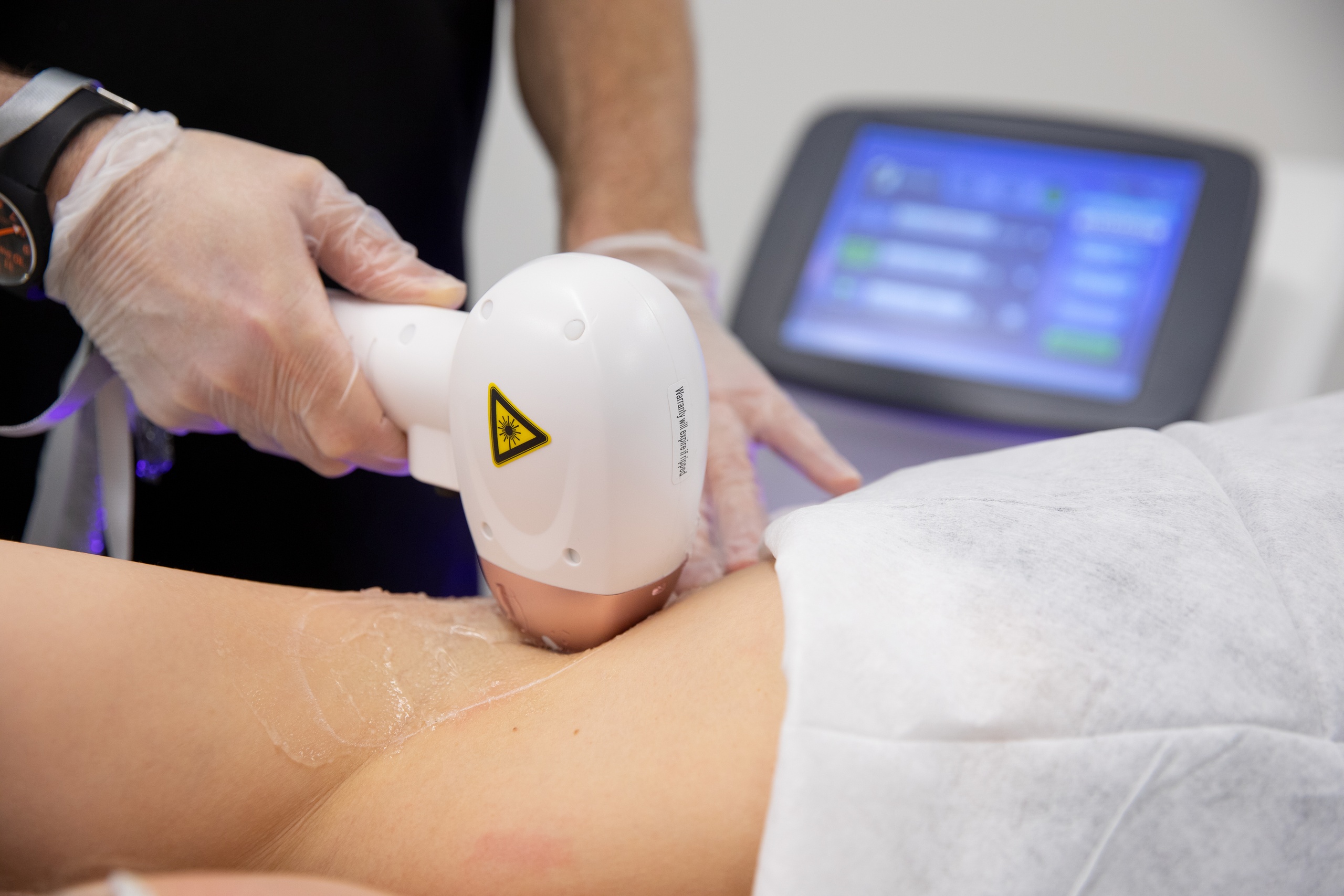 لیزر موهای زائد بیکینی در شیراز