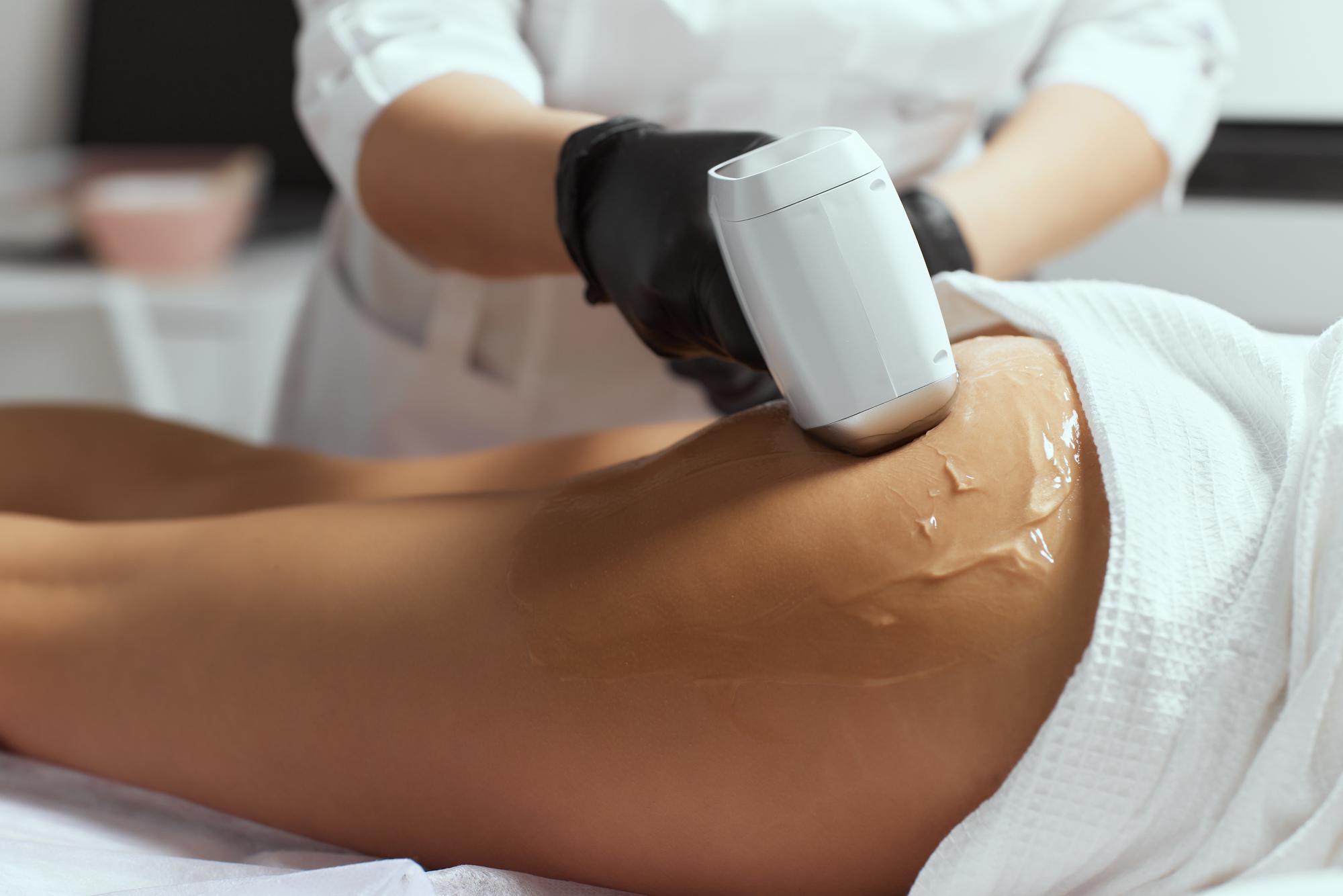 لیزر موهای زائد باسن در شیراز